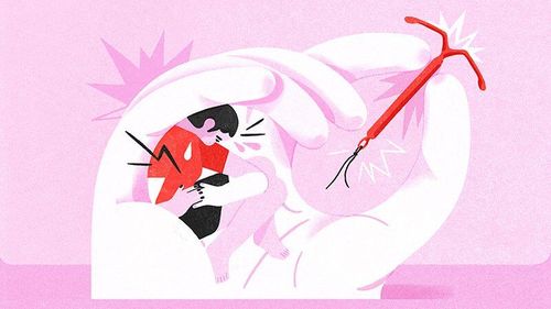 Why Is Pain Relief Not Offered For IUD Insertion?