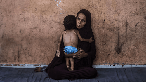 Children Are Starving In Gaza, And All Their Mothers Can Do Is Watch: Inside The Human Cost Of A “Man-Made Famine” 